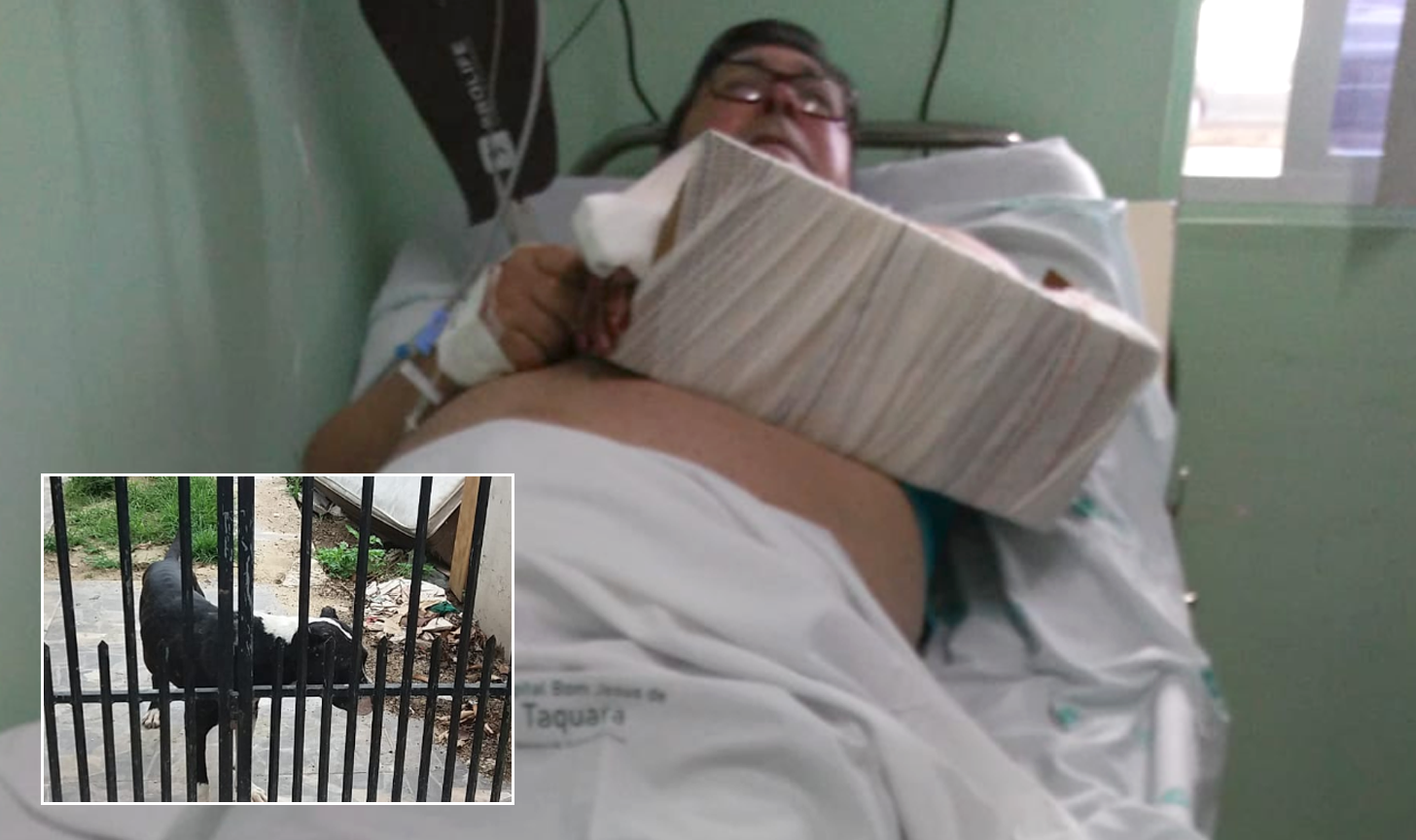 Idoso tem braço dilacerado por pitbull após salvar criança de ataque em Taquara