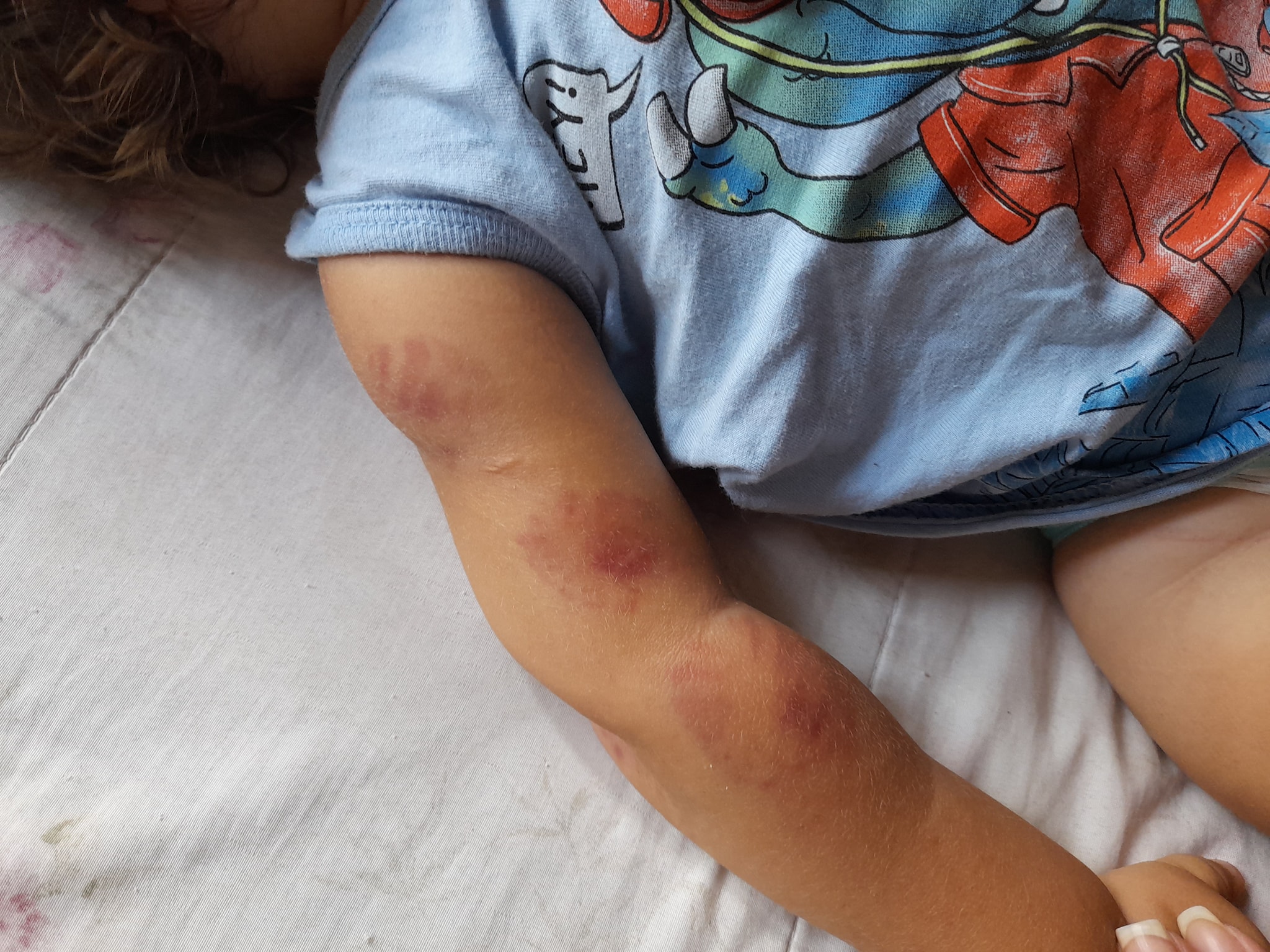 Prefeitura de Taquara oferece suporte à família de criança mordida em escola de educação infantil