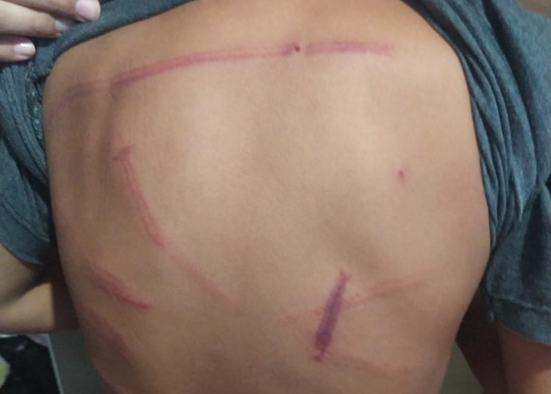 Mãe é presa em flagrante após agredir o filho de apenas três anos em Taquara