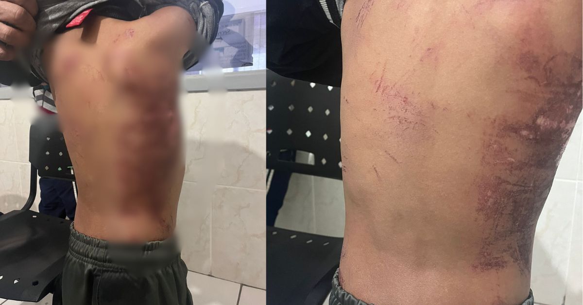 Pai é preso por agressão e tortura a crianças em Taquara
