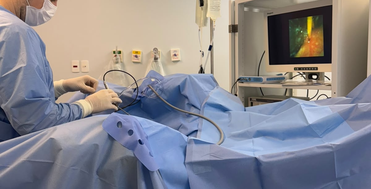 Hospital inicia tratamento de cálculos renais a laser pelo SUS em Parobé